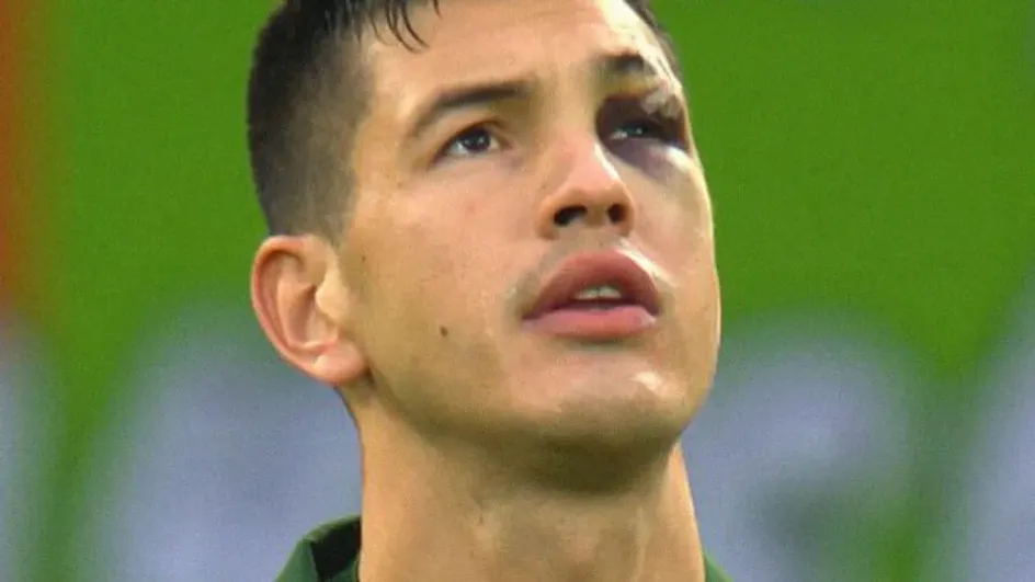 Защитник «Локо» Монтес вышел на матч РПЛ с фингалом Защитник «Локо» Монтес вышел на матч РПЛ с фингалом